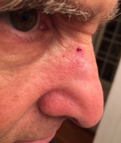 Dr_Wheatgrass_Steve_Carcinoma_1